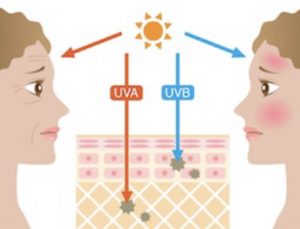 The effects of UV-rays on ageing and burning