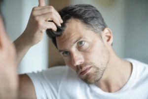 Non Surgical hair loss treatments